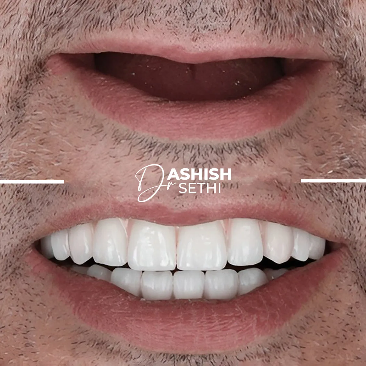 Before and After Transformation 5